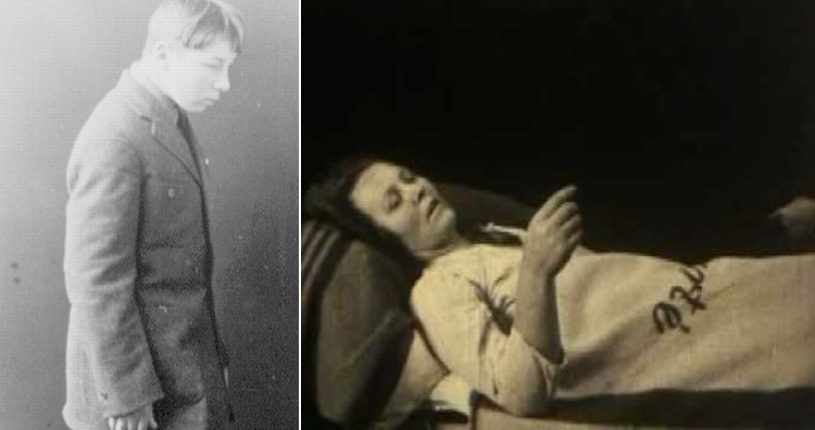 encephalitis lethargica